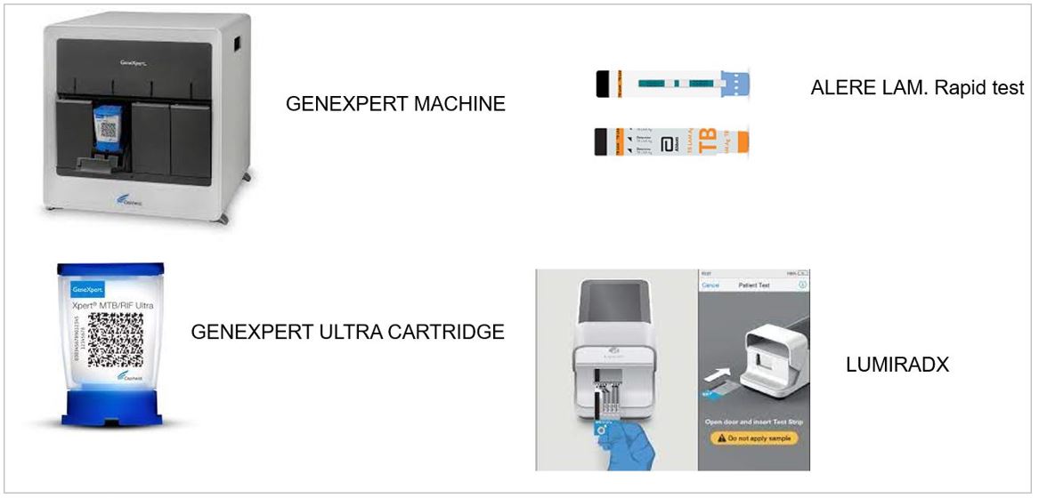 Expanding Xpert Ultra for TB diagnosis among HIV-positive patients admitted to hospitals in Africa