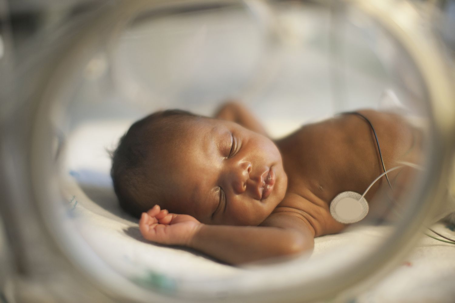Severe neonatal infection adaptive platform trials in Africa (SNIP-AFRICA)