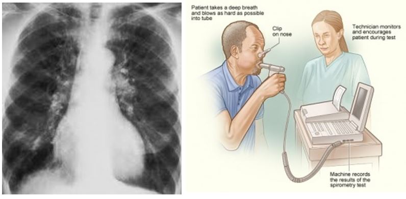 Tackling the hidden epidemic of non-communicable diseases in sub-Saharan Africa: Developing the Else Kröner Center for Heart and Lung Disease (EKC-HLD)